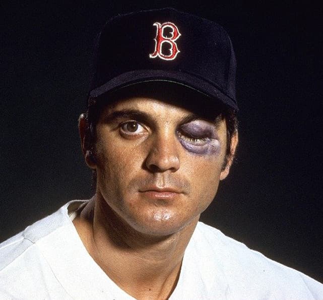 Tony Conigliaro Boston Red Sox